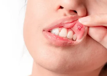 nowthendigital.com__causes Types-of-mouth-sores-oral sex
