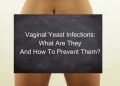 nowthendigital.com__causes-vaginal-itching-1