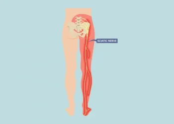 nowthendigital.com_symptoms-and-causes-of-Sciatica Nerve Pain