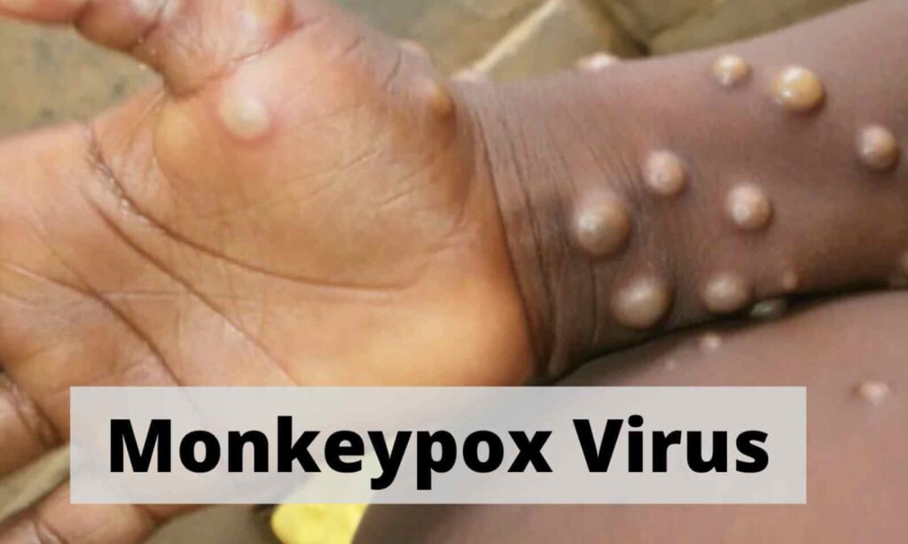 Jynneos generates immunity to monkeypox (1)