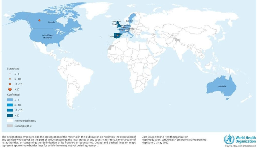 monkeypox outbreaks (1)