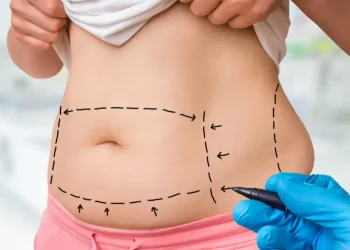 How does liposuction work