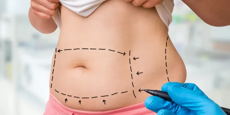 How does liposuction work