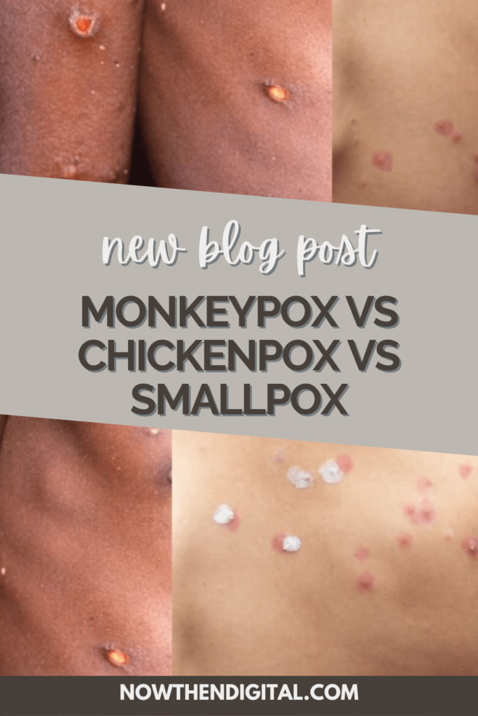 Monkeypox Vs Chickenpox Vs Smallpox (1)