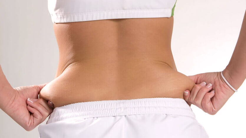 What Is liposuction