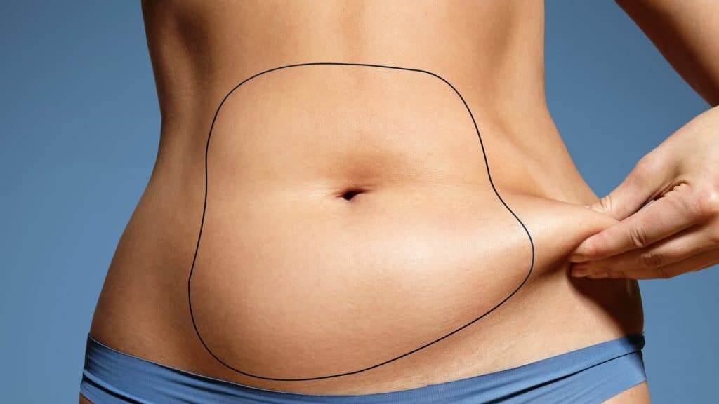 What can liposuction treat