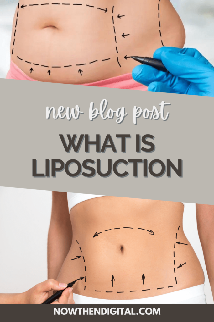 liposuction side effects (1)