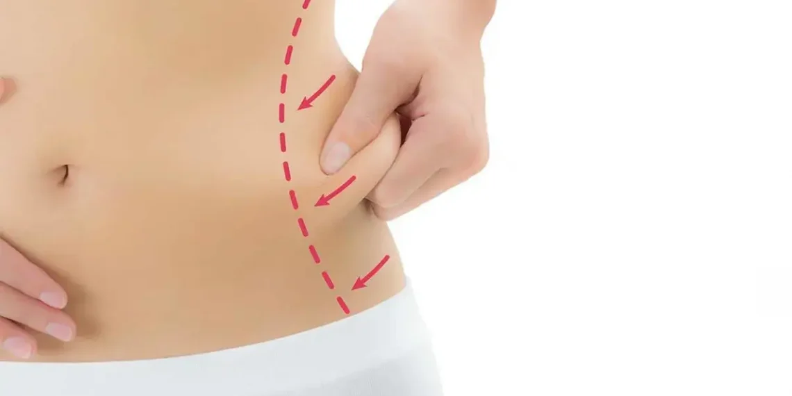 types of liposuction