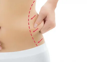 types of liposuction