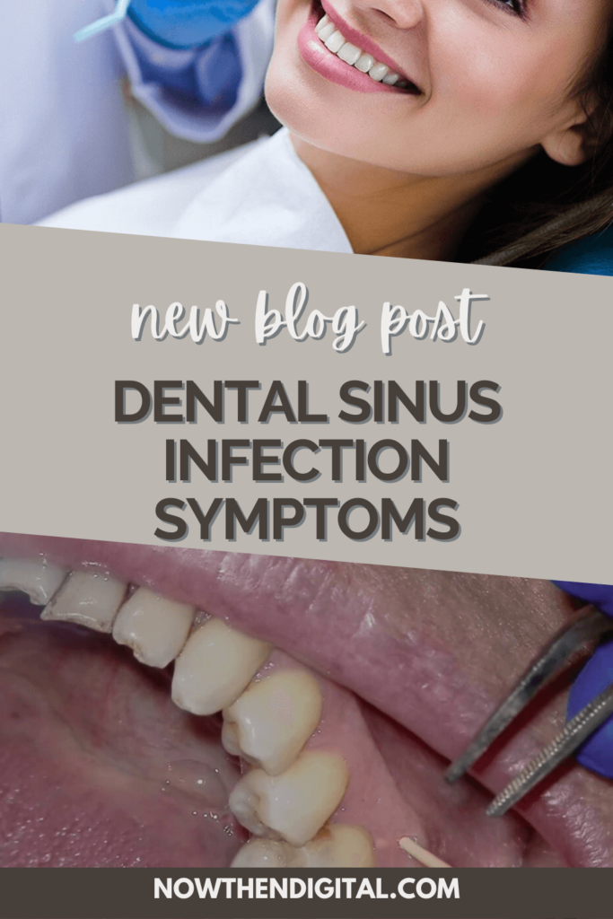 sinus infection toothache (1)
