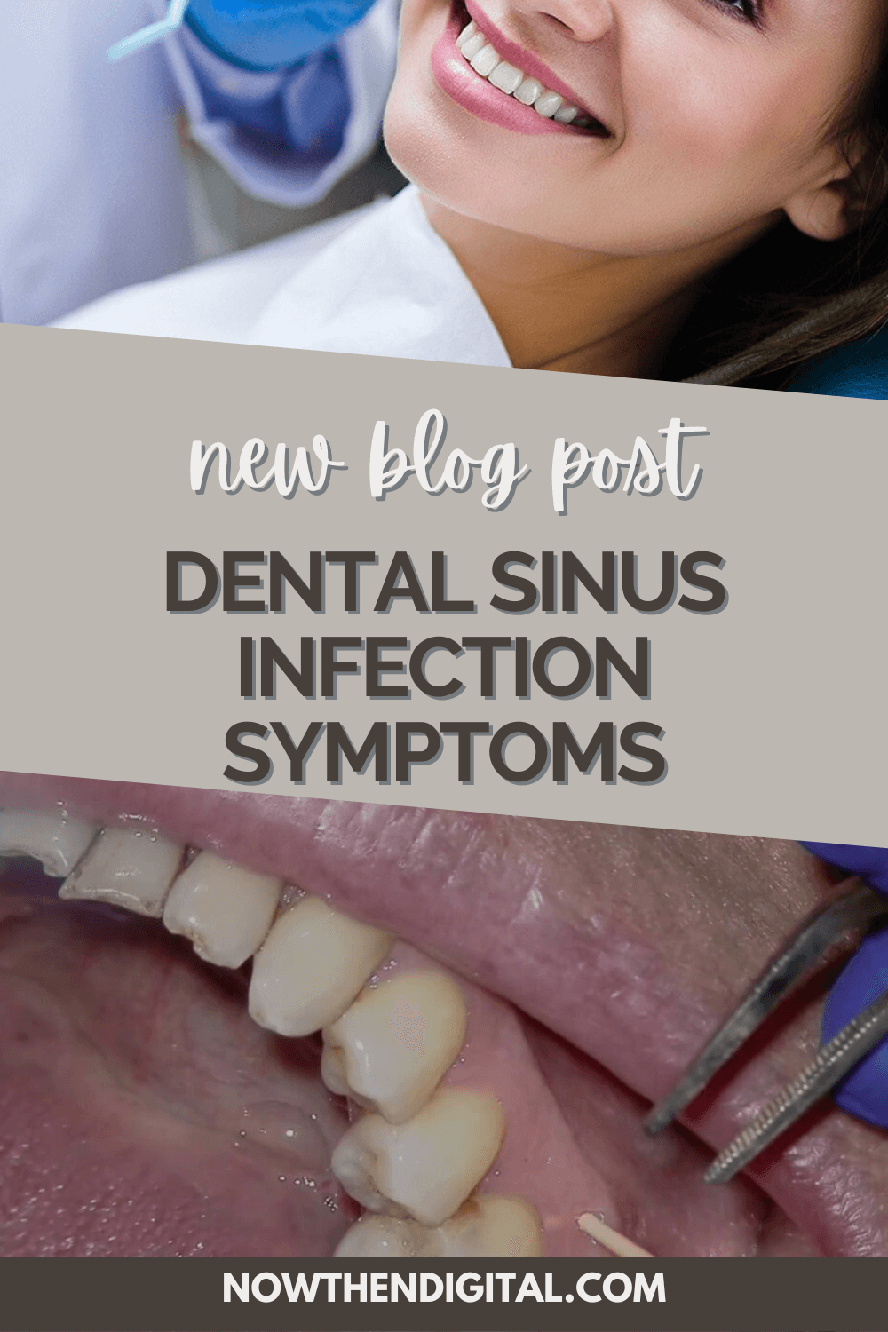 Dental Sinus Infection Symptoms Finally Revealed - Now Then Digital