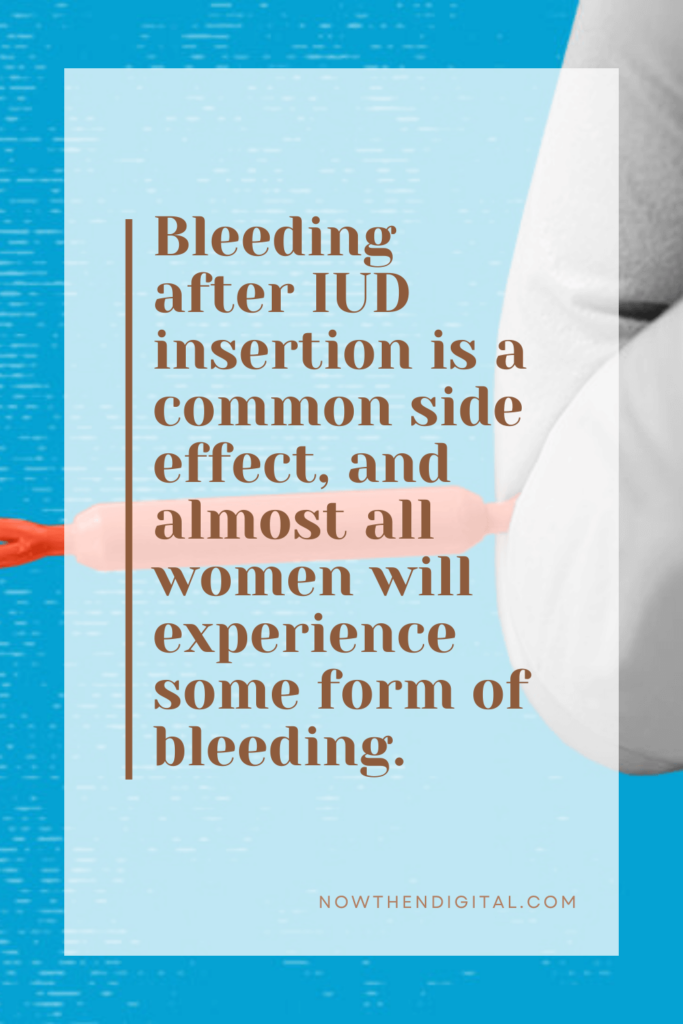 IUD insertion