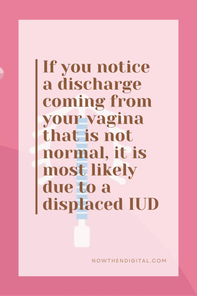 Signs of a displaced IUD