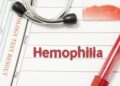 hemophilia symptoms treatments