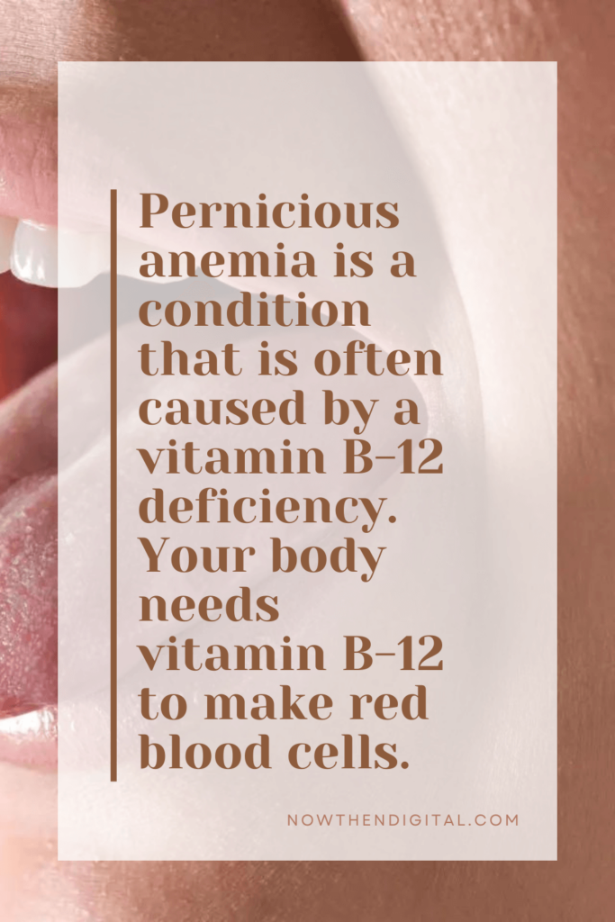iron deficiency anemia tongue pictures