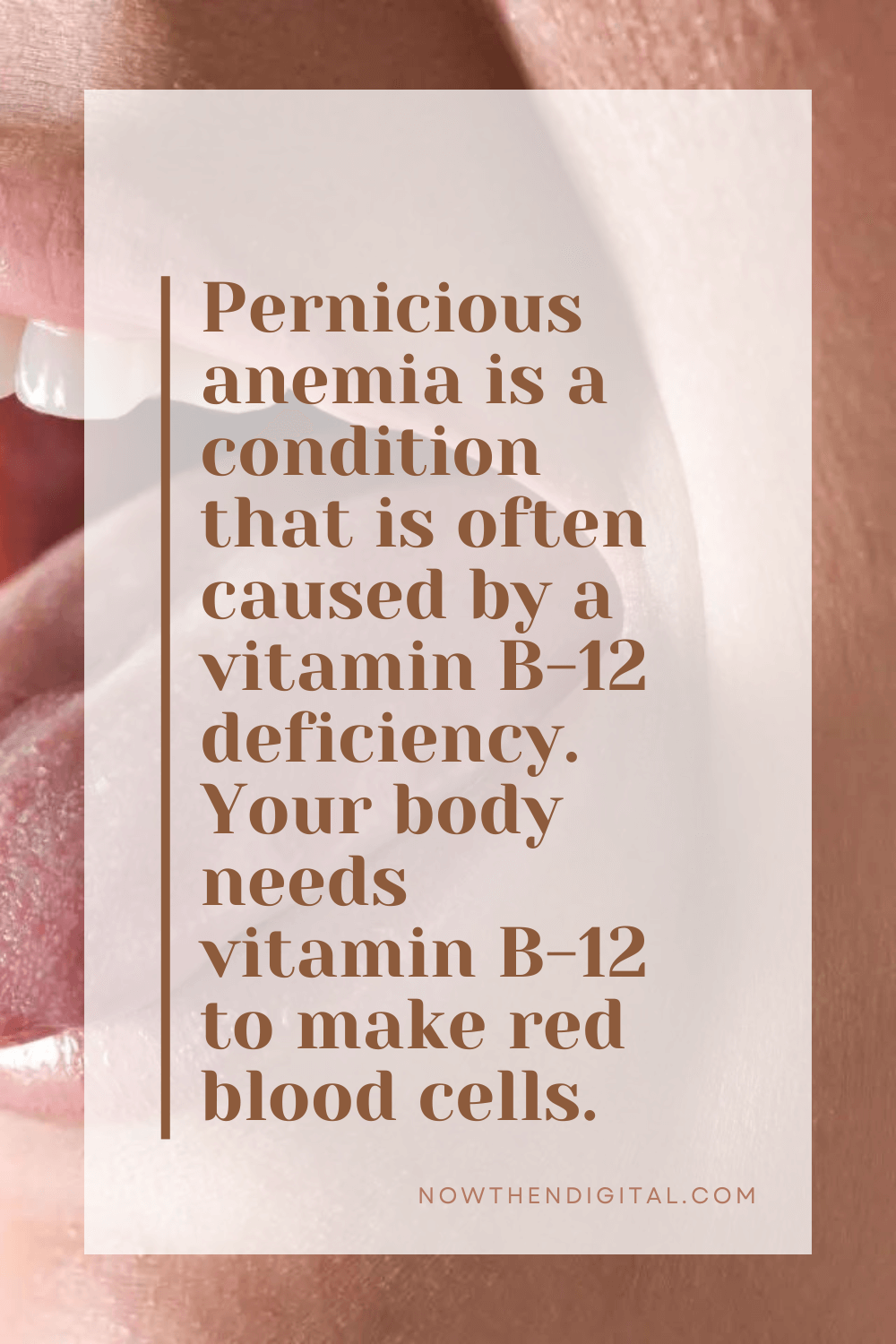 What Is Pernicious Anemia Tongue, and How Is It Treated? Now Then Digital