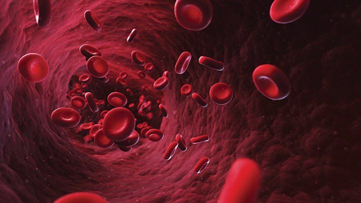 sideroblastic anemia causes