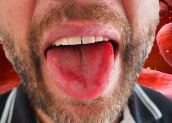 what is pernicious anemia