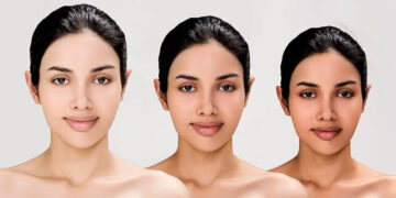 top 10 skin bleaching creams