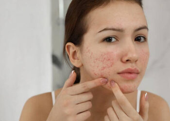 manage skin inflammation tips