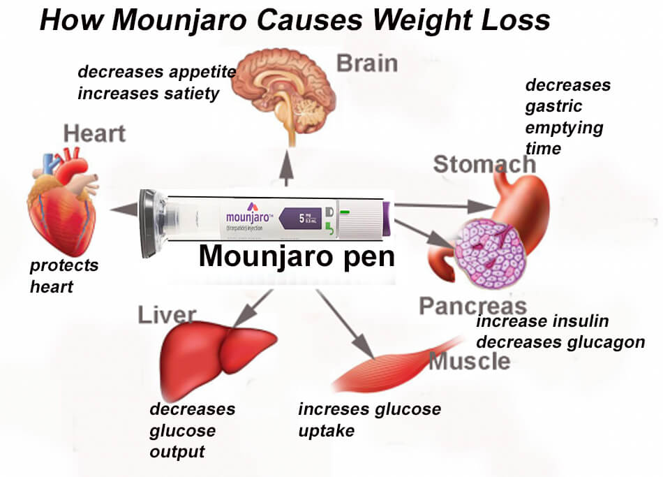 Mounjaro side effects