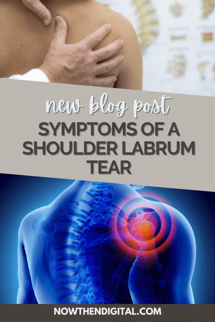 how to know if you have labrum tear of shoulder