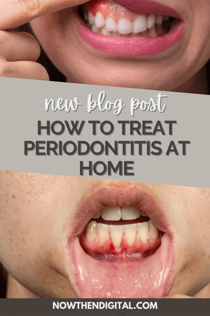 how to treat periodontitis