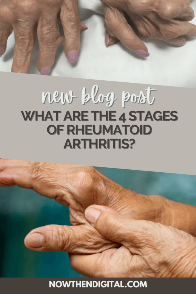 rheumatoid arthritis symptoms in hands