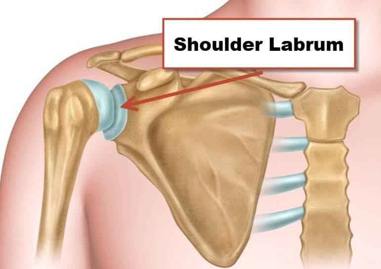 shoulder labrum tear types