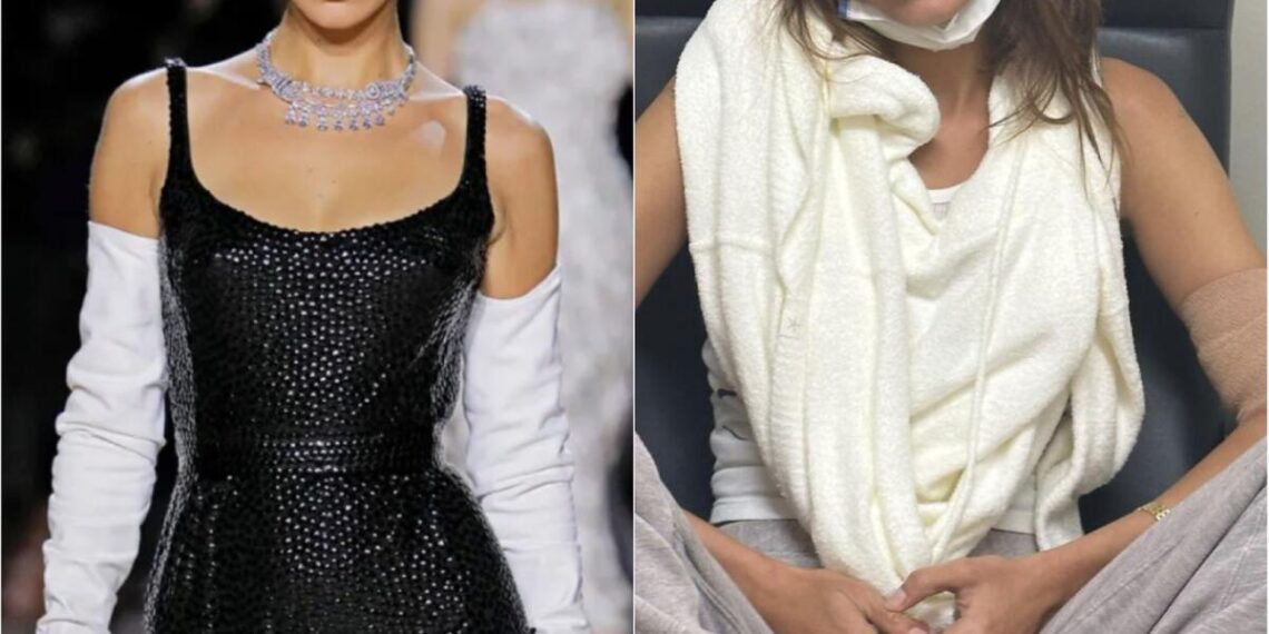 Bella Hadid's Struggle with Lyme Disease