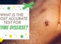 how to test for lyme disease