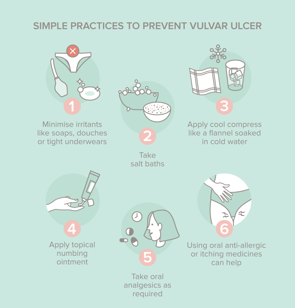 vulvar ulcers treatment and prevention